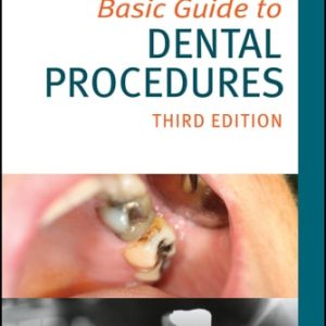 Basic Guide to Dental Procedures (3rd Edition)
