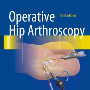 Operative Hip Arthroscopy (3rd Edition)