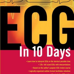 ECG in Ten Days: Second Edition