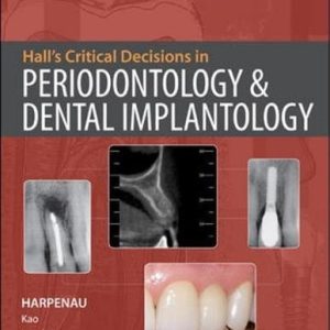 Hall's Critical Decisions in Periodontology & Dental Implantology, 5e