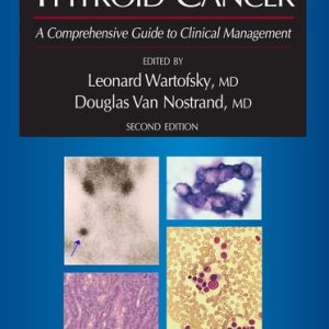 Thyroid Cancer (A Comprehensive Guide to Clinical Management) (2nd Edition)