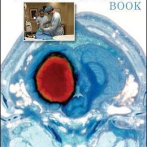 The NeuroICU Book (2nd Edition)
