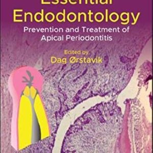 Essential Endodontology (Prevention and Treatment of Apical Periodontitis) (3rd Edition)