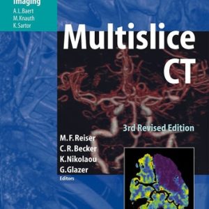 Multislice CT (3rd Edition)