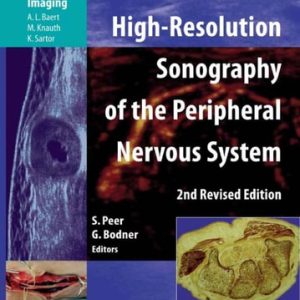High-Resolution Sonography of the Peripheral Nervous System (2nd Edition)