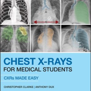 Chest X-Rays for Medical Students (2nd Edition)
