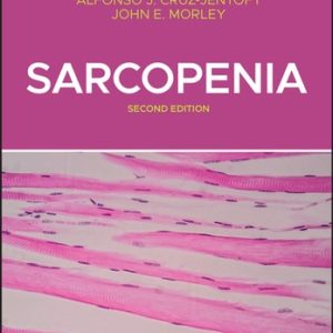 Sarcopenia, 2nd Edition