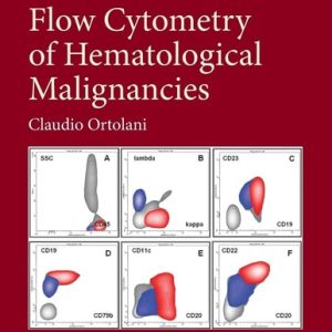 Flow Cytometry of Hematological Malignancies (2nd Edition)