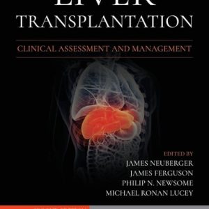 Liver Transplantation: Clinical Assessment and Management, 2nd Edition