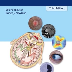 Neuro-Ophthalmology Illustrated (3rd Edition)