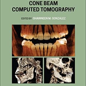 Interpretation Basics of Cone Beam Computed Tomography (2nd Edition)
