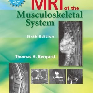 MRI of the Musculoskeletal System (6th Edition)