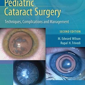 Pediatric Cataract Surgery (Techniques, Complications and Management) (2nd Edition)