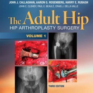 The Adult Hip (Hip Arthroplasty Surgery) (3rd Edition)