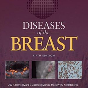 Diseases of the Breast (5th Edition)