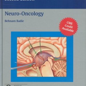 Neuro-Oncology (2nd Edition)
