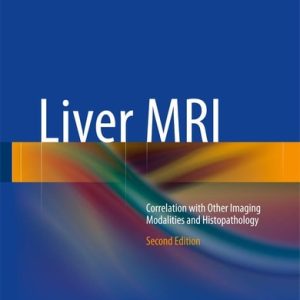 Liver MRI (Correlation with Other Imaging Modalities and Histopathology) (2nd Edition)