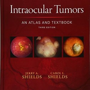 Intraocular Tumors: An Atlas and Textbook (3rd Edition)