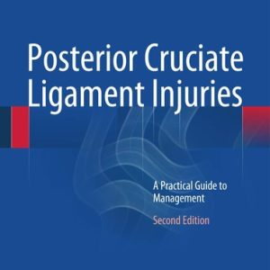 Posterior Cruciate Ligament Injuries (A Practical Guide to Management) (2nd Edition)