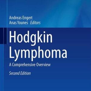Hodgkin Lymphoma (A Comprehensive Overview) (2nd Edition)