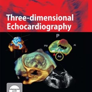 Three-dimensional Echocardiography