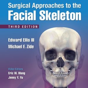 Surgical Approaches to the Facial Skeleton (3rd Edition)