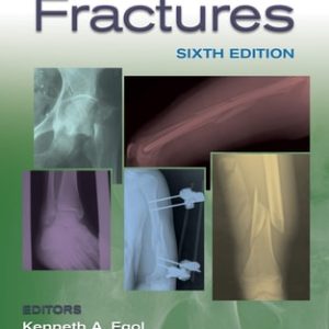 Handbook of Fractures (6th Edition)