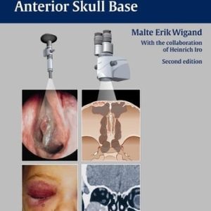 Endoscopic Surgery of the Paranasal Sinuses and Anterior Skull Base (2nd Edition)