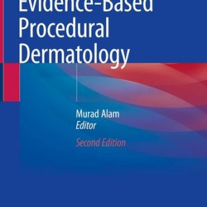 Evidence-Based Procedural Dermatology (2nd Edition)