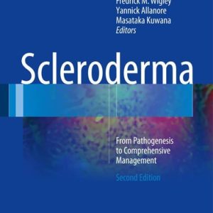 Scleroderma (From Pathogenesis to Comprehensive Management) (2nd Edition)