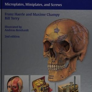 Atlas of Craniomaxillofacial Osteosynthesis (Microplates, Miniplates, and Screws) (2nd Edition)