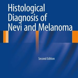 Histological Diagnosis of Nevi and Melanoma (2nd Edition)