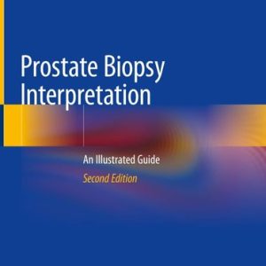 Prostate Biopsy Interpretation (An Illustrated Guide) (2nd Edition)