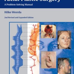 Reconstructive Facial Plastic Surgery (A Problem-Solving Manual) (2nd Edition)