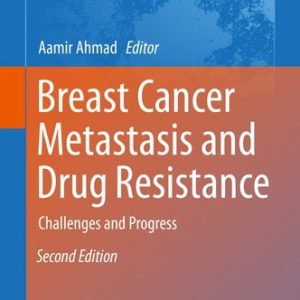 Breast Cancer Metastasis and Drug Resistance (Challenges and Progress) (2nd Edition)