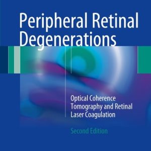 Peripheral Retinal Degenerations (Optical Coherence Tomography and Retinal Laser Coagulation) (2nd Edition)