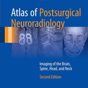 Atlas of Postsurgical Neuroradiology (Imaging of the Brain, Spine, Head, and Neck) (2nd Edition)