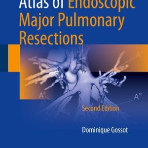 Atlas of Endoscopic Major Pulmonary Resections (2nd Edition)