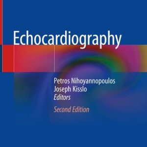 Echocardiography (2nd Edition)