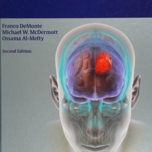 Al-Mefty's Meningiomas (2nd Edition)