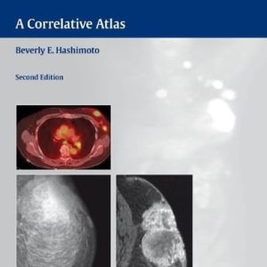 Multimodality Breast Imaging (A Correlative Atlas) (2nd Edition)