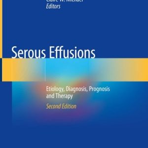 Serous Effusions (Etiology, Diagnosis, Prognosis and Therapy) (2nd Edition)