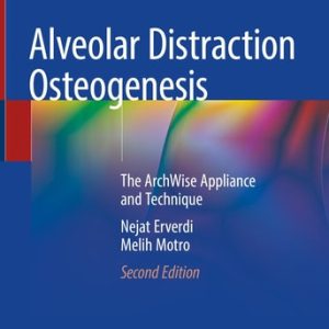 Alveolar Distraction Osteogenesis (The ArchWise Appliance and Technique) (2nd Edition)