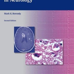Comprehensive Board Review in Neurology (2nd Edition)