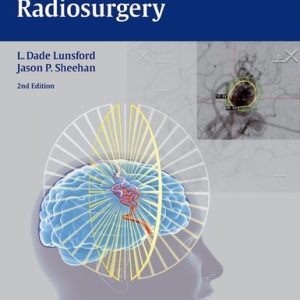 Intracranial Stereotactic Radiosurgery (2nd Edition)