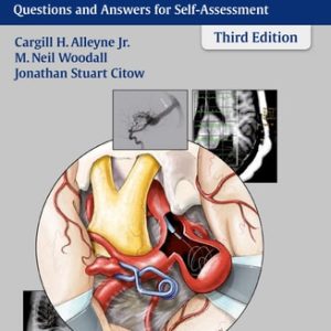 Neurosurgery Board Review (Questions and Answers for Self-Assessment) (3rd Edition)
