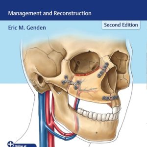 Head and Neck Cancer (Management and Reconstruction) (2nd Edition)