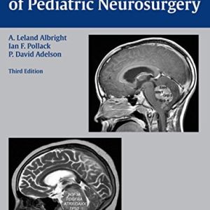 Principles and Practice of Pediatric Neurosurgery (3rd Edition)