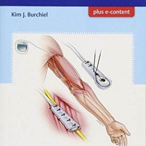 Handbook of Pain Surgery