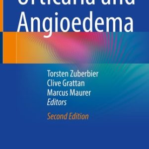 Urticaria and Angioedema (2nd Edition)